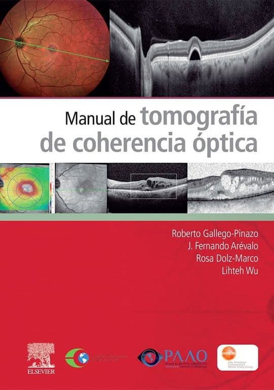 Libro Manual De Tomografia De Coherencia Optica