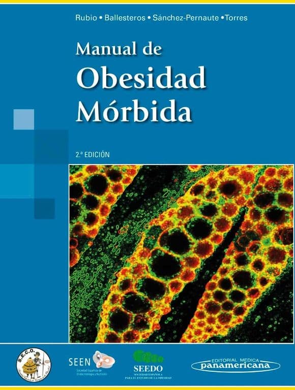 Libro Manual De Obesidad Morbida 2Ed