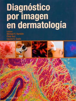 Libro Diagnostico por imagen en dermatologia